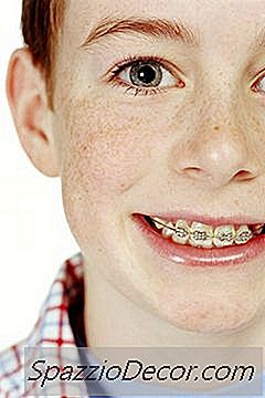 Ayuda Financiera Para Frenillos Para Dientes De Niños