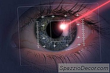 ¿Puedo Deducir Gastos Ópticos?