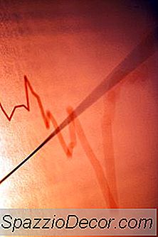 Como É Que Um Desdobramento De Ações Afeta O Patrimônio Líquido?