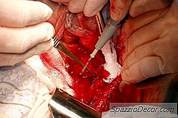 Kedilerde Pectus Excavatum