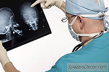 Cinci Sarcini De La O Descriere A Unei Posturi Pentru Un Neurochirurg