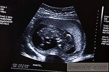 Cara Menjadi Juruteknik Ultrasound Di Kanada