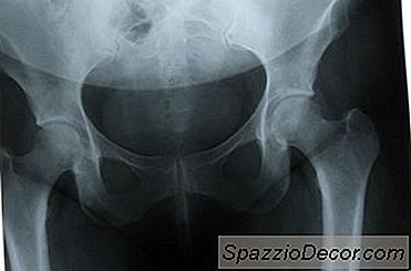 Exercícios Concêntricos Para Rotação Lateral Dos Quadris