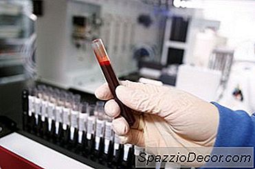 Sağlıklı Serum Demir Seviyesi Nedir?